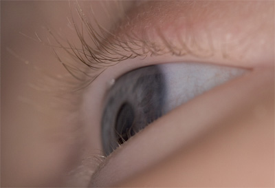 eye-small